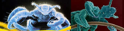Lice - Zionsville Community Schools