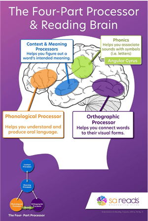 Brain picture 2