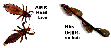 How Long Can Lice Survive on Clothes: Essential Facts