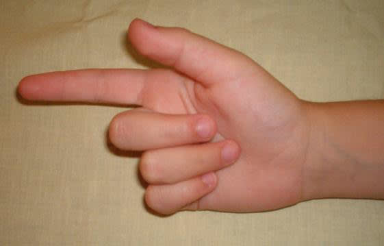 A hand with fingers extended and thumb pointing upwards